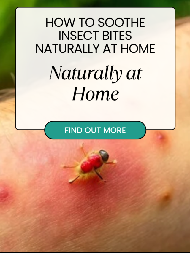 How to Soothe Insect Bites Naturally at Home